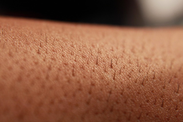 ihokarvat lähikuvassa